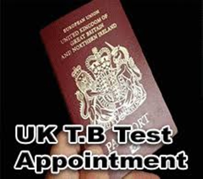 Tb Test Uk Visa